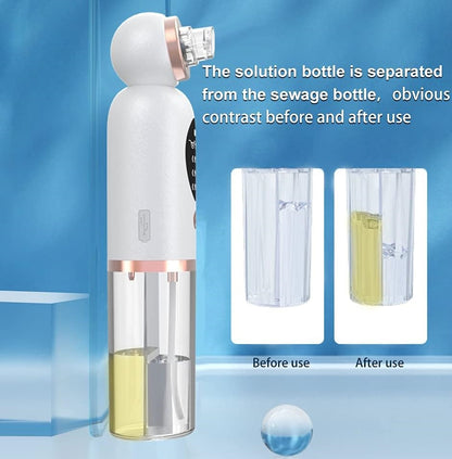 Super Micro Bubble Beauty Instrument Blackhead Remover - Missha Middle East