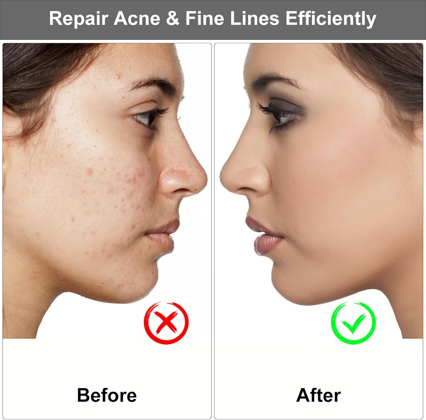 Derma Stamp 0.5 mm Titanium Microneedle Stamper - Missha Middle East