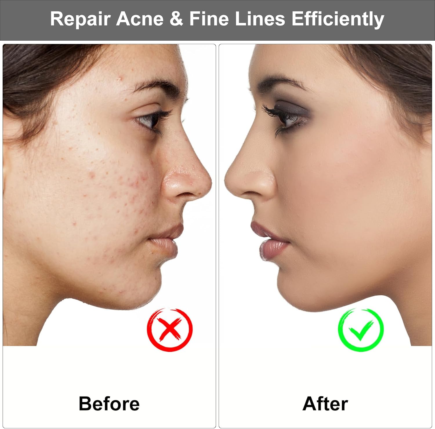 Derma Stamp 0.5 mm Titanium Microneedle Stamper - Missha Middle East